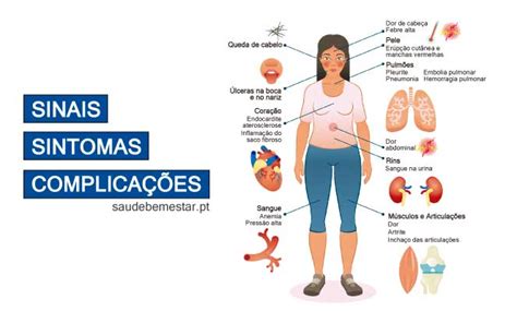 por o lupo|Lúpus: o que é, sintomas, tipos, causas e tratamento